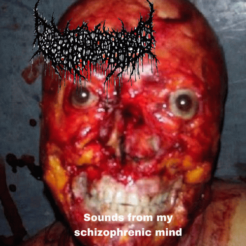 Sounds from My Schizophrenic Mind